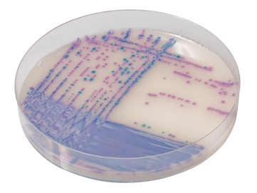 CHROMagar™ Salmonella PLUS base and supplement